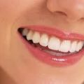 10 tips voor witte tanden